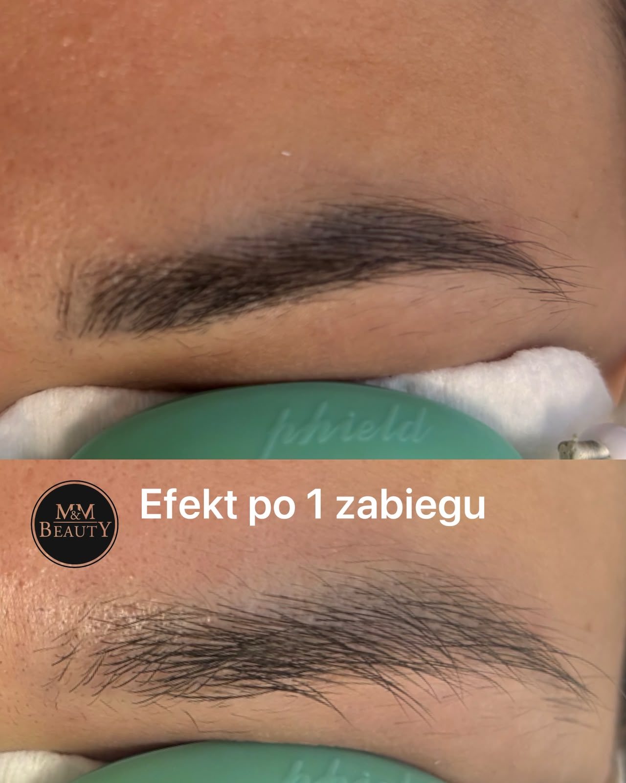 Brwi po pierwszym zabiegu laserowego usuwania makijażu permanentnego